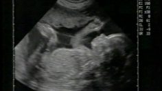 poster-10921-spa-le-foetus-236x132