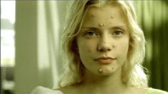 poster-13997-axion-dexia-acne-juvenile-chantant-236x132